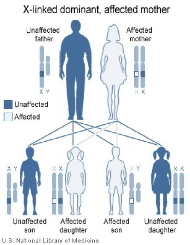 Diagramm eines X-vererblichen dominanten Familienstammbaums mit einer betroffenen Mutter und erklärendem Text.